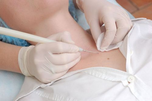 Hautveränderungen entfernen